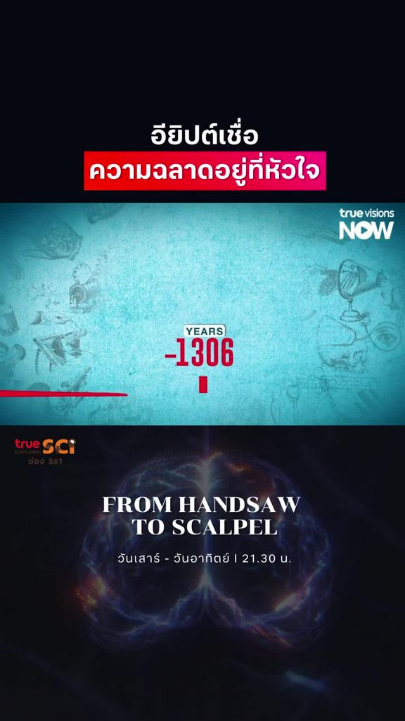 หัวใจมันสำคัญ เลยเกิดความเข้าใจแบบผิดๆ l FROM HANDSAW TO SCALPEL S1 & S2